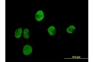 Image no. 2 for anti-Replication Protein A2, 32kDa (RPA2) (AA 1-270) antibody (ABIN519842)