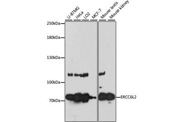 ERCC6L2 抗体  (AA 1262-1561)