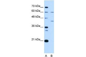 anti-Replication Factor C (Activator 1) 5, 36.5kDa (RFC5) (N-Term) antibody