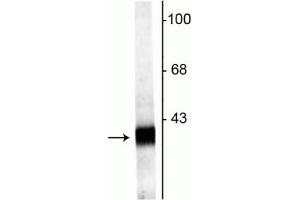Image no. 2 for anti-Synaptoporin (SYNPR) (C-Term) antibody (ABIN361521)