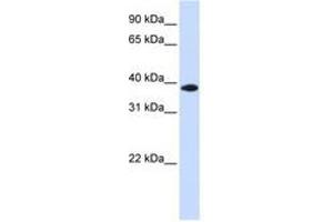 Image no. 1 for anti-Glycerol-3-Phosphate Dehydrogenase 1-Like (GPD1L) (C-Term) antibody (ABIN6741288)
