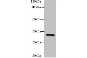 Western blot All lanes: PPP1R3B antibody at 6 μg/mL + Mouse liver tissue Secondary Goat polyclonal to rabbit IgG at 1/10000 dilution Predicted band size: 33 kDa Observed band size: 33 kDa