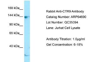 Image no. 1 for anti-RNA Polymerase-Associated Protein CTR9 Homolog (CTR9) (C-Term) antibody (ABIN2789925)