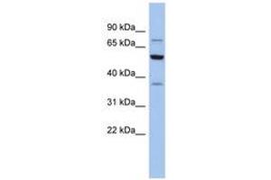 Image no. 1 for anti-Glycyl-tRNA Synthetase (GARS) (AA 575-624) antibody (ABIN6744313)