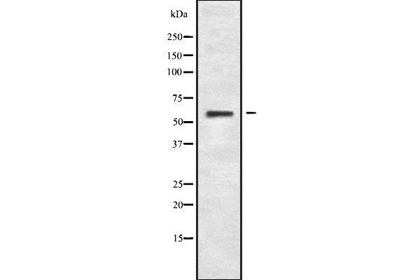 SLC16A6 antibody