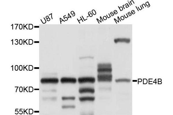 anti-phosphodiesterase 4B, cAMP-Specific (PDE4B) antibody