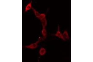 Image no. 1 for anti-Serotonin Receptor 5A (HTR5A) antibody (ABIN6257898)