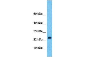 Image no. 1 for anti-LIM Domain Only 2 (Rhombotin-Like 1) (LMO2) (N-Term) antibody (ABIN2777181)