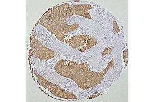 Image no. 4 for anti-Keratin 19 (KRT19) antibody (ABIN4956434)