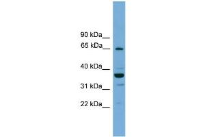 Image no. 2 for anti-TH1-Like (TH1L) (N-Term) antibody (ABIN2787403)