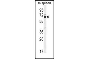 Image no. 1 for anti-Leiomodin 2 (LMOD2) (AA 67-96), (N-Term) antibody (ABIN953197)