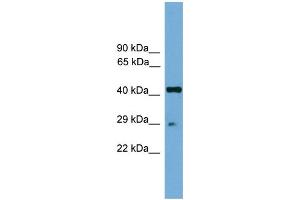 Image no. 1 for anti-Regulatory Factor X-Associated Protein (RFXAP) (Middle Region) antibody (ABIN2780100)