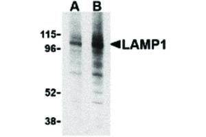 Image no. 1 for anti-Lysosomal-Associated Membrane Protein 1 (LAMP1) (Internal Region) antibody (ABIN6656655)