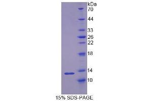 Image no. 1 for Resistin (RETN) (AA 22-109) protein (S tag,His tag) (ABIN6238564)