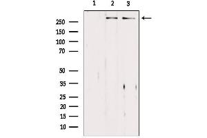 Image no. 1 for anti-Asp (Abnormal Spindle) Homolog, Microcephaly Associated (ASPM) (Internal Region) antibody (ABIN6260082)