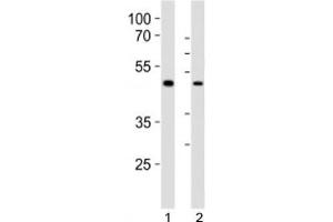 Image no. 2 for anti-SRY (Sex Determining Region Y)-Box 17 (SOX17) (C-Term) antibody (ABIN3032723)