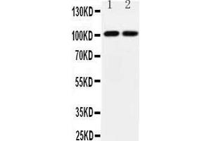 anti-Glutamate Receptor, Ionotropic, AMPA 3 (GRIA3) (AA 394-412), (Middle Region) antibody