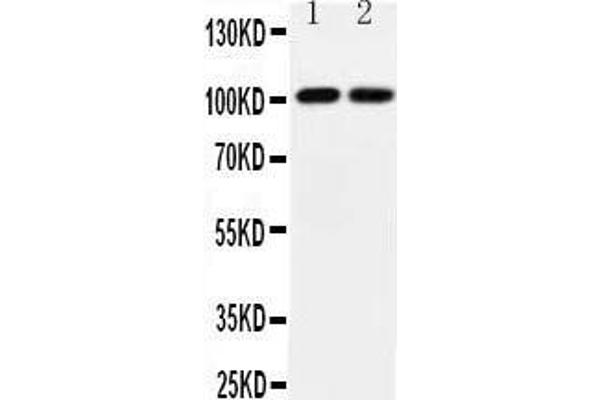 anti-Glutamate Receptor, Ionotropic, AMPA 3 (GRIA3) (AA 394-412), (Middle Region) antibody