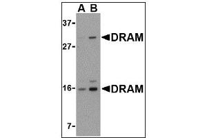 Image no. 2 for anti-DNA-Damage Regulated Autophagy Modulator 1 (DRAM1) (C-Term) antibody (ABIN372924)