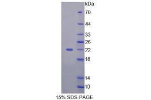 Image no. 1 for Cyclin-Dependent Kinase Inhibitor 2D (p19, Inhibits CDK4) (CDKN2D) (AA 1-166) protein (ABIN6239470)