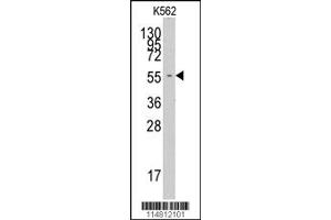Western Blotting (WB) image for anti-Phenylalanyl-tRNA Synthetase, alpha Subunit (FARSA) antibody (ABIN2158796)