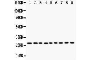 Image no. 2 for anti-Kallikrein 6 (KLK6) (AA 227-244), (C-Term) antibody (ABIN3044157)