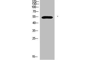 GCM2 Antikörper  (AA 21-70)