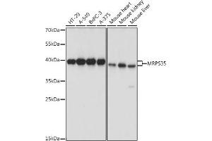 MRPS35 Antikörper  (AA 1-323)