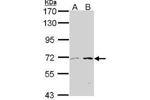 Image no. 2 for anti-Carnitine O-Octanoyltransferase (CROT) (Internal Region) antibody (ABIN2856069)