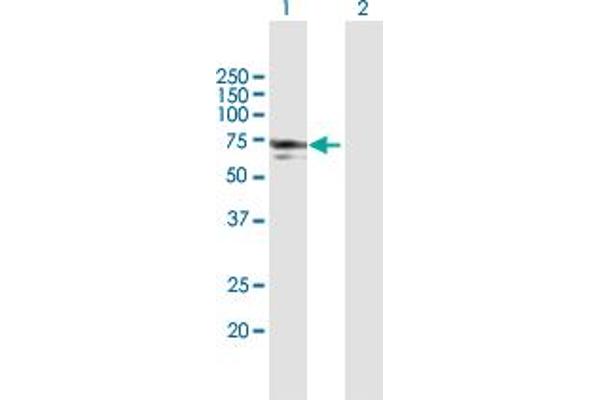 anti-N-Myristoyltransferase 1 (NMT1) (AA 1-496) antibody
