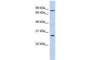 Image no. 1 for anti-Kruppel-Like Factor 12 (KLF12) (AA 51-100) antibody (ABIN6742325)