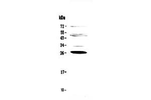 Image no. 1 for anti-Complement Factor D (CFD) (AA 26-253) antibody (ABIN5692792)