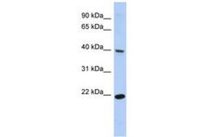 Image no. 1 for anti-Single Stranded DNA Binding Protein 4 (SSBP4) (C-Term) antibody (ABIN6742646)