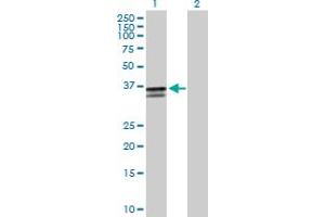 Image no. 1 for anti-ST3 beta-Galactoside alpha-2,3-Sialyltransferase 2 (ST3GAL2) (AA 1-350) antibody (ABIN520194)
