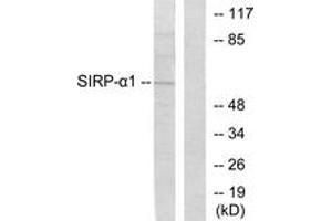 Image no. 1 for anti-Signal-Regulatory Protein alpha (SIRPA) (AA 451-500) antibody (ABIN1533397)