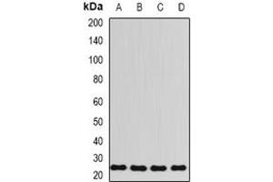 Image no. 1 for anti-Ribosomal Protein L13 (RPL13) (full length) antibody (ABIN6005448)