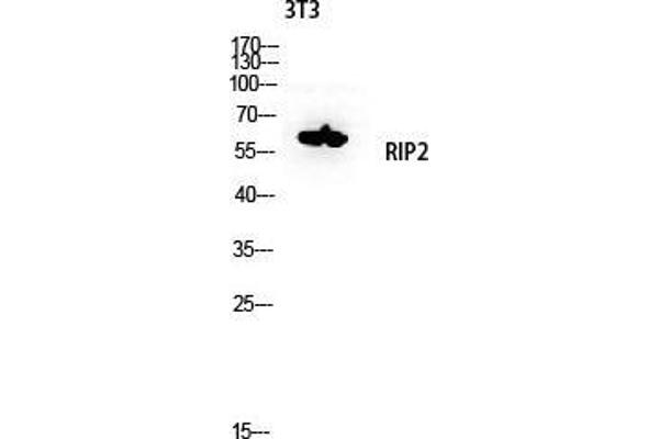 anti-ROP Interactive Partner 2 (RIP2) (Tyr397) antibody