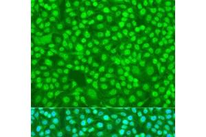 Immunofluorescence analysis of U2OS cells using SFRS9 Polyclonal Antibody at dilution of 1:100.