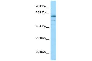 Image no. 1 for anti-Dihydropyrimidinase-Like 4 (DPYSL4) (C-Term) antibody (ABIN2790103)