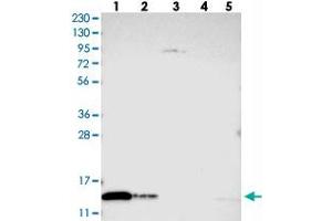 Image no. 1 for anti-Thioredoxin Domain Containing 17 (TXNDC17) antibody (ABIN5590416)
