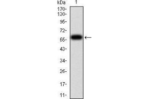 Image no. 4 for anti-Histone Deacetylase 6 (HDAC6) (AA 482-800) antibody (ABIN5542328)