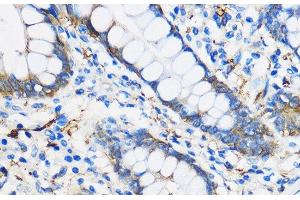 Immunohistochemistry of paraffin-embedded Human colon using PPAR gamma Polyclonal Antibody at dilution of 1:100 (40x lens).