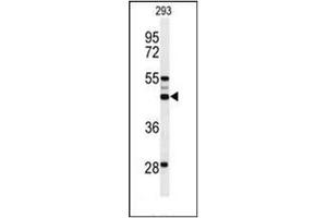 Image no. 1 for anti-Organic Solute Transporter alpha (OSTALPHA) (AA 305-335), (C-Term) antibody (ABIN953943)