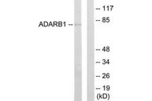 Image no. 1 for anti-Adenosine Deaminase, RNA-Specific, B1 (ADARB1) (AA 481-530) antibody (ABIN1533808)