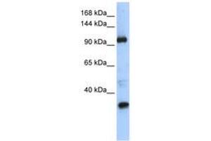 Image no. 1 for anti-Terminal Uridylyl Transferase 1, U6 SnRNA-Specific (TUT1) (AA 829-878) antibody (ABIN6740612)
