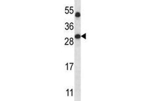 Image no. 3 for anti-Sirtuin 5 (SIRT5) (AA 99-127) antibody (ABIN3032594)