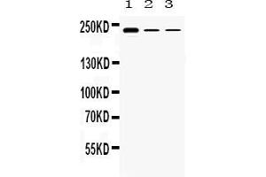 Image no. 4 for anti-Tectorin alpha (TECTA) (AA 93-134), (N-Term) antibody (ABIN5518790)