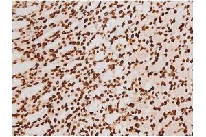Image no. 18 for anti-REL proto-oncogene (c-Rel) (pSer503) antibody (ABIN6255382)