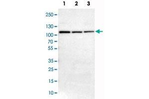 Image no. 2 for anti-Adenylate Kinase 7 (AK7) antibody (ABIN5572259)
