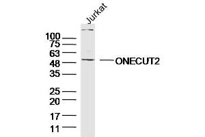 Image no. 2 for anti-One Cut Homeobox 2 (ONECUT2) (AA 401-504) antibody (ABIN5557503)